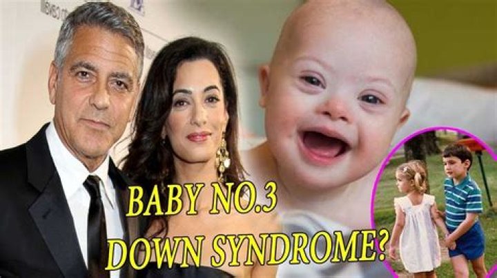 How George Clooney's Twins Are Challenging Down Syndrome Stereotypes