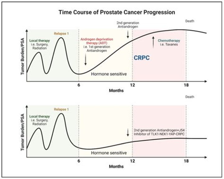 Understanding Mark Levin's Prostate Cancer Journey